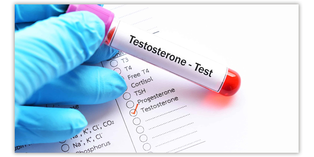 Test For Testosterone Levels